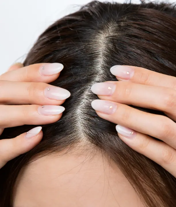Les cheveux écartés raie par raie pour observer le cuir chevelu